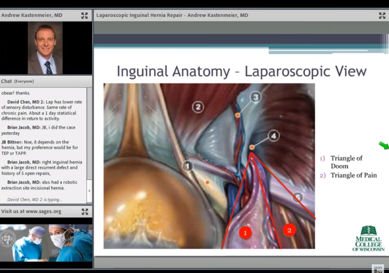 Laparoscopic Inguinal Hernia Repair Anatomy Anatomy Structure Sexiz Pix